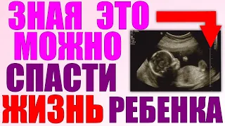 ДЕФИЦИТ МАССЫ ТЕЛА ПЛОДА | Что делать если у плода выявлен дефицит массы тела