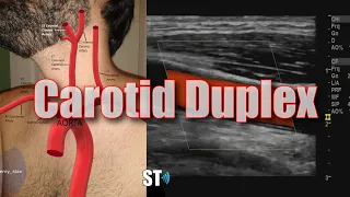 Carotid Duplex Exam