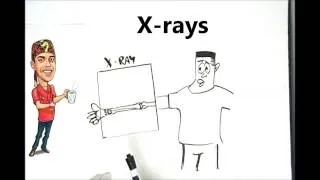 What is an X-ray Explained Simply
