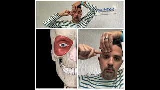 Eye Closing : Clip From The Bell's Palsy Tutorial
