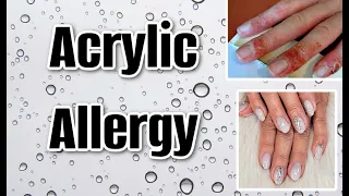 WHAT TO DO?? nail alternative and remedy