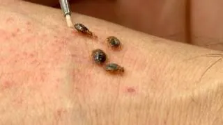 Meet the Bed Bug!