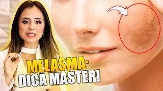 MELASMA: DICA FÁCIL, SIMPLES E INFALÍVEL PARA DIMINUIR E ACABAR COM O MELASMA (COMPROVADO)