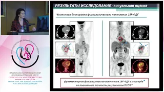 Защита диссертации Пурсанова Д. М.