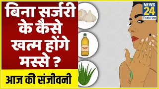 Sanjeevani : जानिए मस्से से छुटकारा पाने के आयुर्वेदिक टिप्स || News24