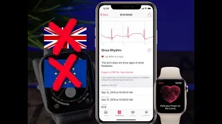 Apple Watch Series 4 NEW ECG APP - Here is The Reason You Can't Get it Outside The US