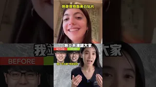 好萊塢完美笑容三部曲#牙齒矯正#切牙齦#牙齒美白