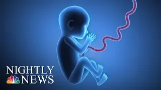 Doctors Tout Life-Saving Benefits Of Umbilical Cord Blood | NBC Nightly News