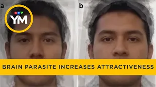Brain parasite makes people appear more attractive | Your Morning