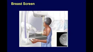 Cancer Screening | Dr Alam