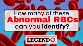 How many abnormal RBC forms can you identify? | Legend Review Center