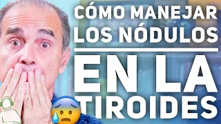 Cómo Manejar Los Nódulos En La Tiroides - Pregúntale A Frank #33