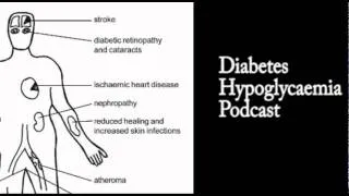 Hypoglycemia