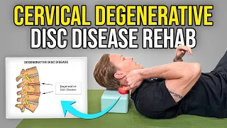 4 Exercises for Cervical Degenerative Disc Disease