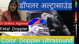 Color Doppler ultrasound /डॉपलर अल्ट्रासाउंड /Arterial  blockage /Fetal Doppler/Doctorhome