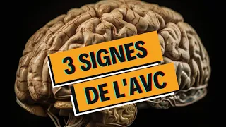 Les 3 signes de l'AVC en 1 minute !