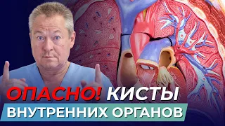 КИСТЫ ВНУТРЕННИХ ОРГАНОВ | ПРИЧИНЫ ПОЯВЛЕНИЯ | КИСТА ЯИЧНИКА | ШКОЛА ЗДОРОВЬЯ и Доктор Божьев