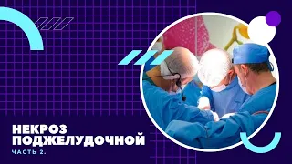 Некроз поджелудочной железы часть 2