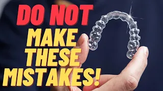The Ultimate Invisalign Guide | Top Things To Know Before You Start!