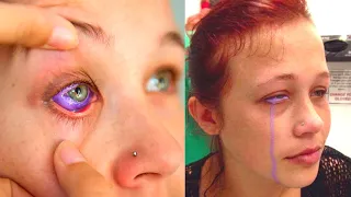 Model Goes Blind Getting Her Eyeballs Tattooed