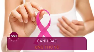 Nhận biết sớm dấu hiệu ung thư vú | VTC Now