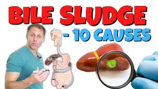 What Causes Poor Bile Flow and Gallbladder Sludge