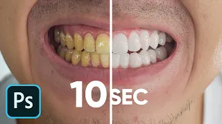 Whiten Teeth in 10 Seconds! (No Clickbait)