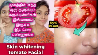 skin whitening facial at home/glass skin/gayus Lifestyle