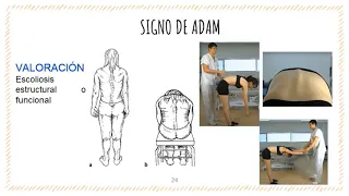 EXPLORACIÓN DE COLUMNA VERTEBRAL