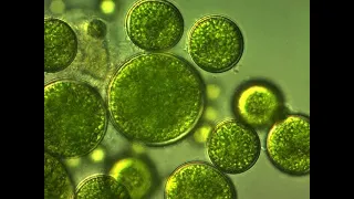 Advancements in Microalgal Technology for the Recovery of Valuable Products