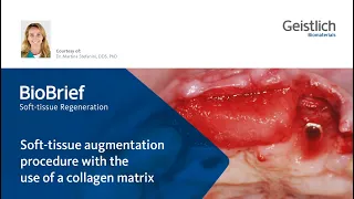 Dr. Martina Stefanini: Soft-tissue augmentationprocedure with the use of a collagen matrix