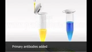 Fluorescence Linked Imminosorbent Assay