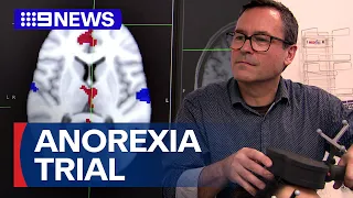 Australian-first trial for anorexia treatment | 9 News Australia