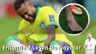 Anatomia da lesão do Neymar