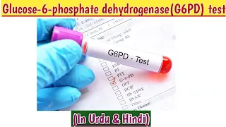 G6PD TEST.what is G6PD? symptoms of G6PD deficiency.cause, purpose,sample collection & normal range.