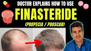 How to use FINASTERIDE (propecia) for BPH / hair loss including doses, side effects & more!