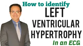 Left Ventricular Hypertrophy ECG Changes (Skolow Lyon Criteria) Explained, ECG Lectures USMLE NEETPG