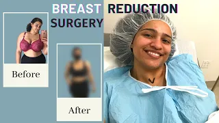 Breast Reduction Surgery | 1 Week Post - Op, Pictures, Vlog + more