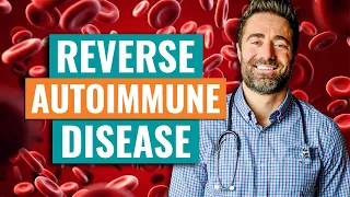 5 Warning Signs of Autoimmune Disease & How To REVERSE It