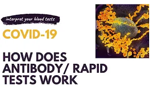 Rapid tests/Antibody tests in corona virus infection(COVID 19):Principle & Interpretation-Dr Kasi MD