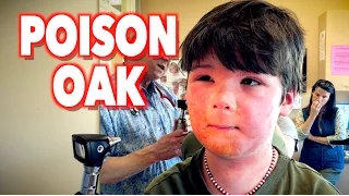 Harsh POISON OAK Reaction | Dr. Paul