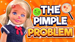 Barbie - The Pimple Problem | Ep.360