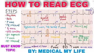 How To Read An ECG