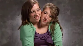 Are Conjoined Twins Abby and Brittany Hensel Married in 2022?