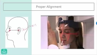 Panoramic Radiography Errors (Part 1) - Chin up, chin down, thin anteriors etc...