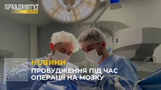Львівські нейрохірурги вперше виконали операцію на мозку, розбудивши пацієнта