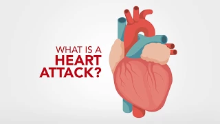 How Heart Attack Signs Differ in Men & Women- Health Plus Animated