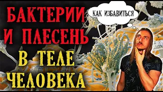 Как избавиться от бактерий и грибков теле | в чем причина всех Болезней?