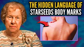 The Truth About the Mysterious Body Marks of Starseeds ✨ Dolores Cannon