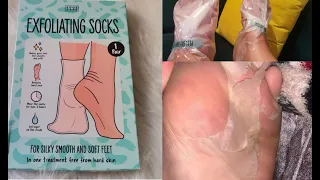 أسهل طريقة لتقشير القدمين بالجوارب السحرية بدون ألم نهار تجربيه عمرك تخطيه exfoliant socks